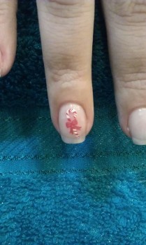 Zuckerstangen Fingernägel Motiv